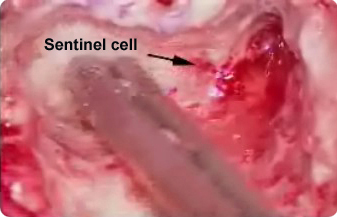 Sentinel Cell